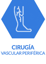 Cirugia Vascular Periferica